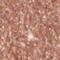 Wet n Wild Color Icon Glitter Single Glitter Lidschatten für Frauen 1,4 g